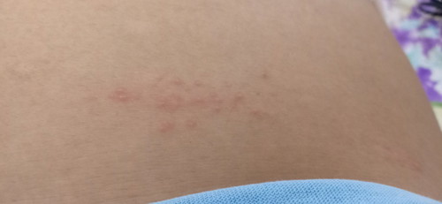 What's this?? im worried ☹️