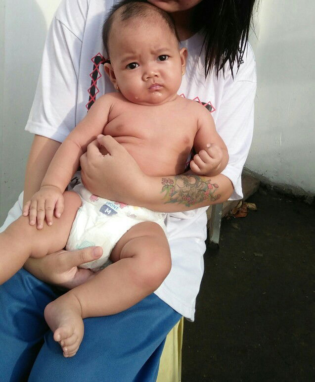 belum bisa menstabilkan kepala umur 4 bulan