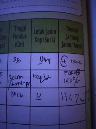letak janin