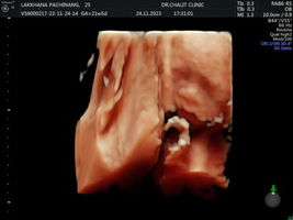 Lakkhana Pajinang profile icon