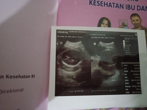 hamil 6 bulan