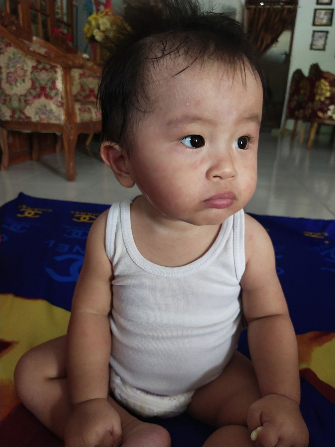 habis demam timbul bercak merah