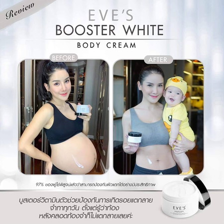 ครีมท้องแตกลาย