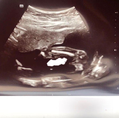 BOY or GIRL??