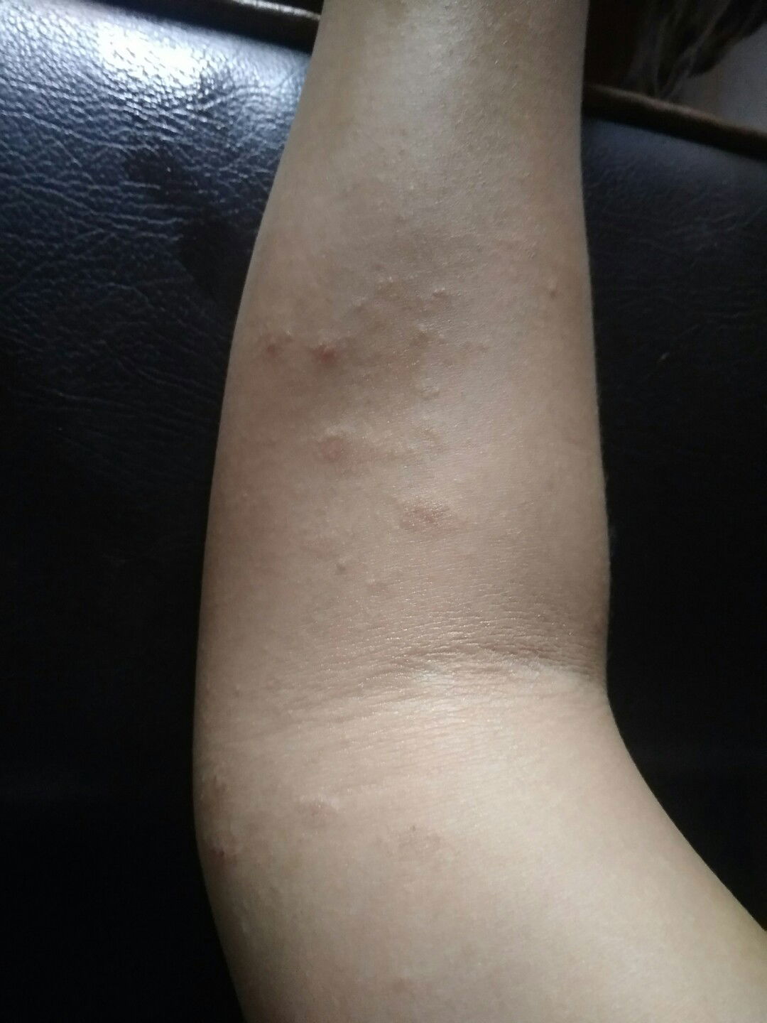 Seperti Jamur Habis Lahiran