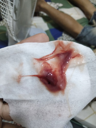 โดนกระตุ้นเป็นแบบนี้ปกติไหม