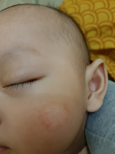 Wajah Bayi