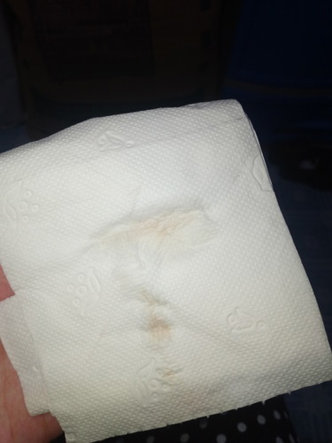 asking (pasintabi po sa mga kumakain this time )