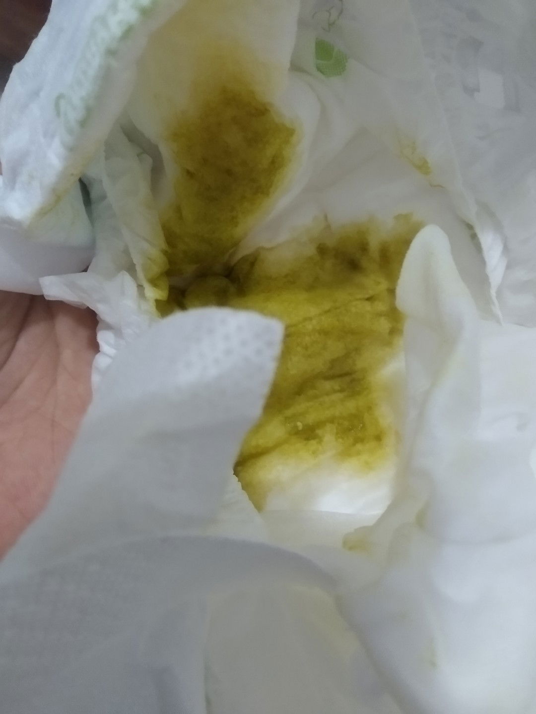 fase pup & perut nya bunyi"