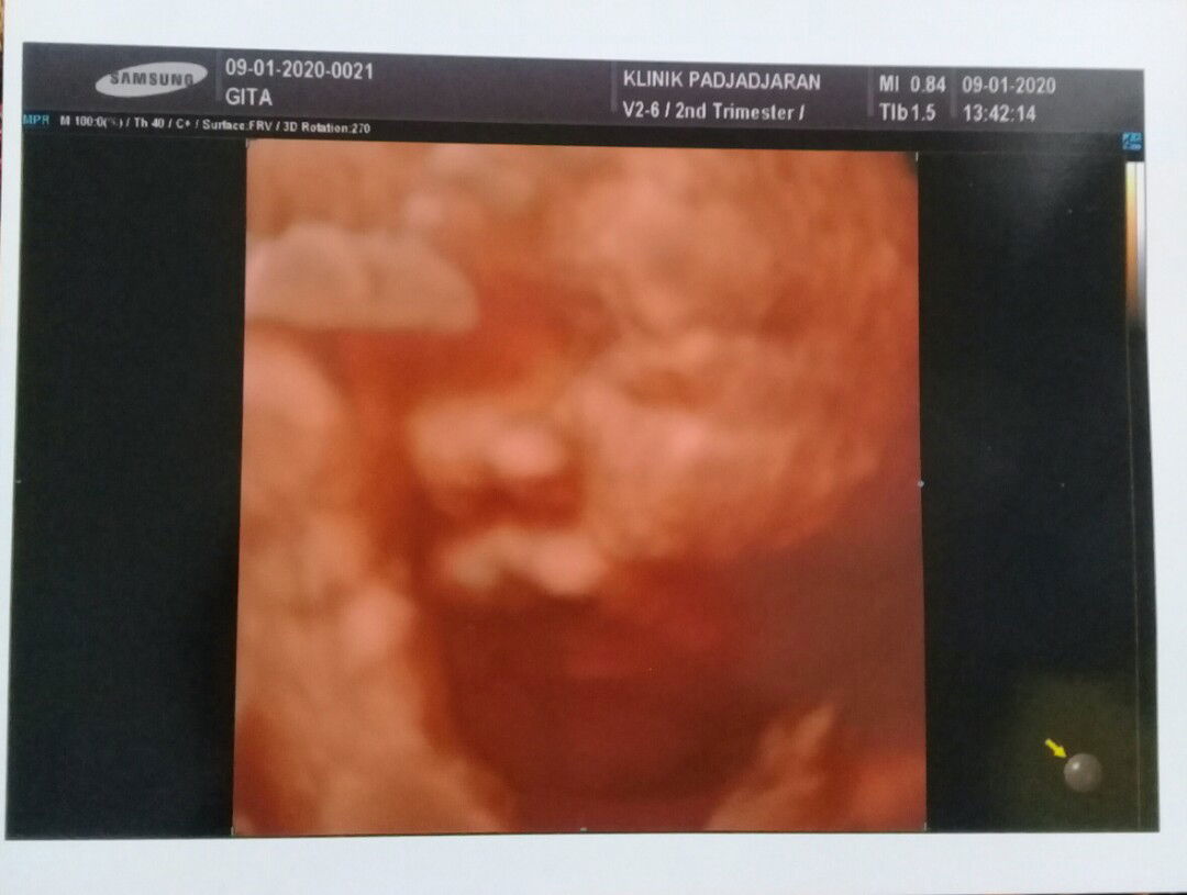 HPL Februari 2020 Ceritakan Pengalamannya