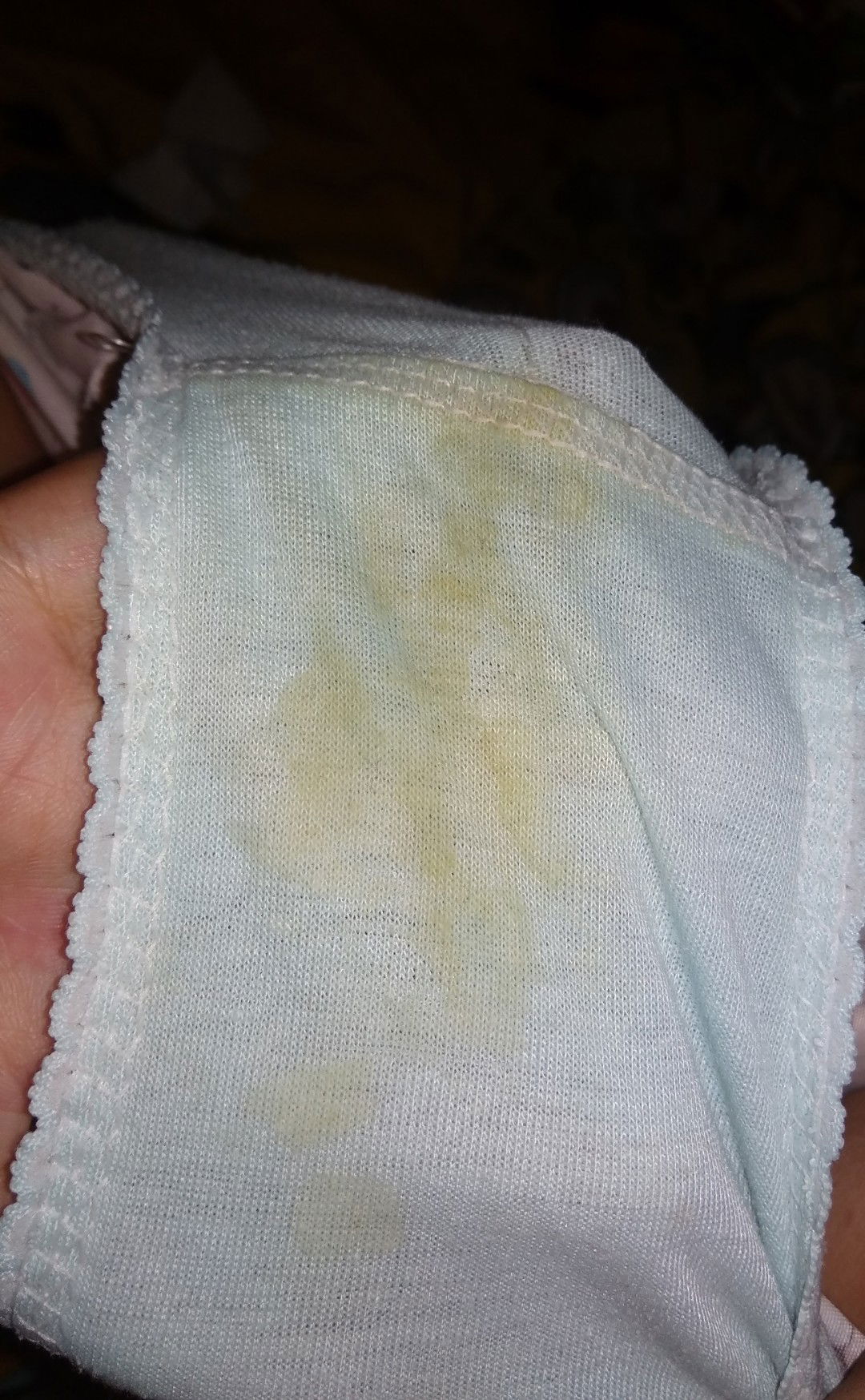 keputihan berwarna kuning yang sudah lumayan lama