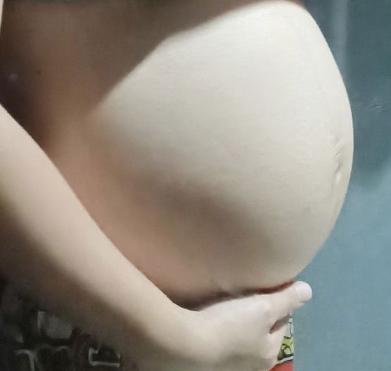 24w1d รู้สึกว่าลูกยังไม่ค่อยดิ้นเลยคะ รู้สึกแค่ไม่ถึง10ครั้งต่อวัน บางวันก็เงียบไม่ดิ้นเลย ปกติไหมคะ