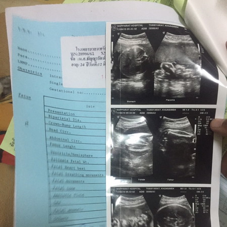 ดูเพศน้องอันไหนค่ะ