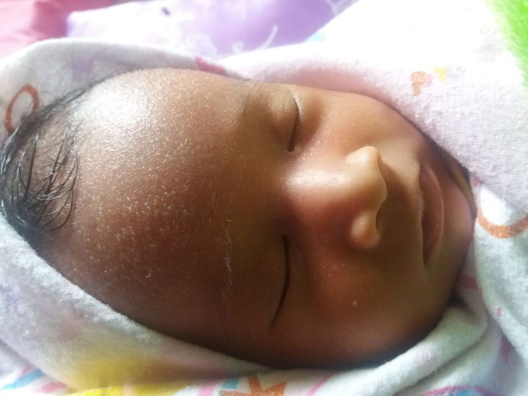 kulit baby meruntus2