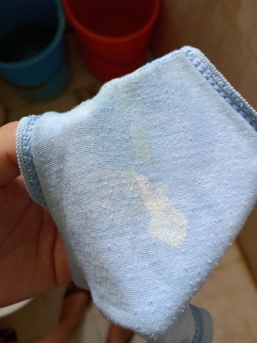 Normal??