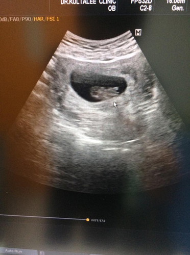 Baby?