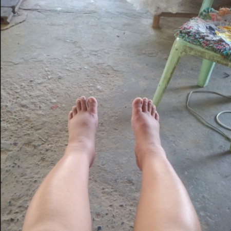 36+5w.ขาเริ่มบวมแล้วค่ะ