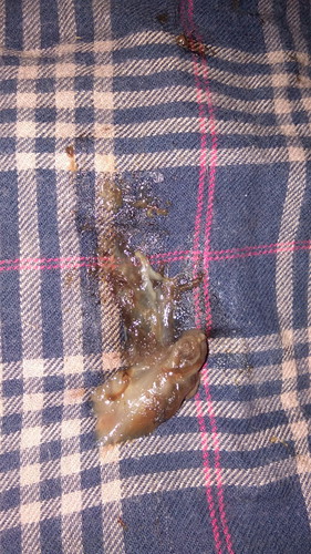 mucus plug nba to!!