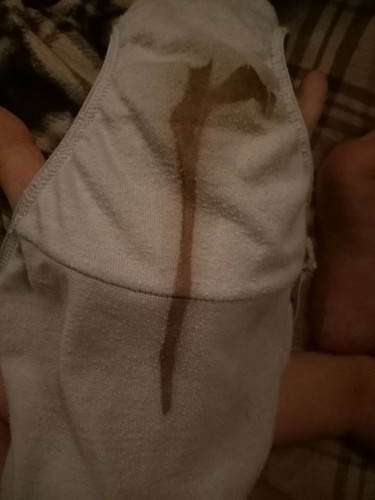 bleed