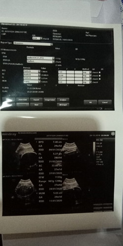 Pregnant 28 weak