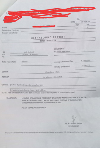 No fetal heartbeat😭