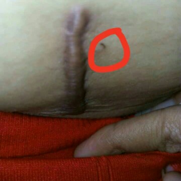 it is normal po ba?