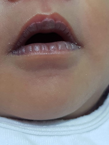 Baby's Lips