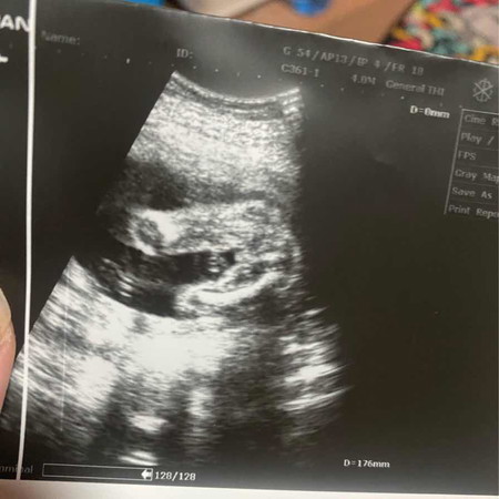 สอบถามเพศลูก