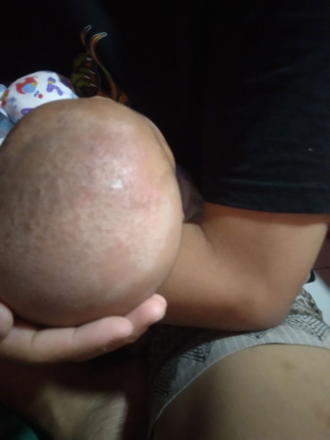 Kerak kepala menjadi kering