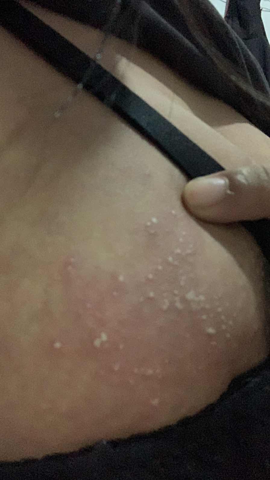 Bunda disini ada yang pernah ngalamin gatal gatal seluruh tubuh ga ya?