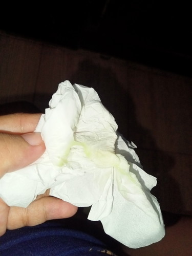 Kluar cairan beserta lendir