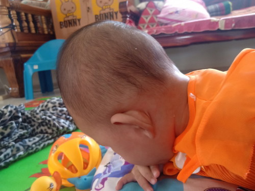 ลูกหัวแบนไหมค่ะ