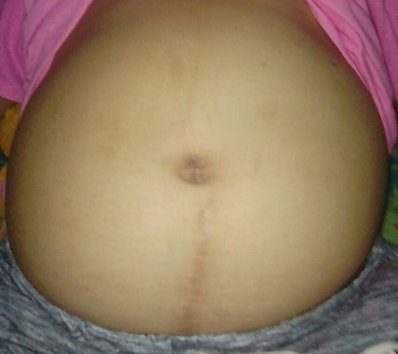 ท้อง6เดือน