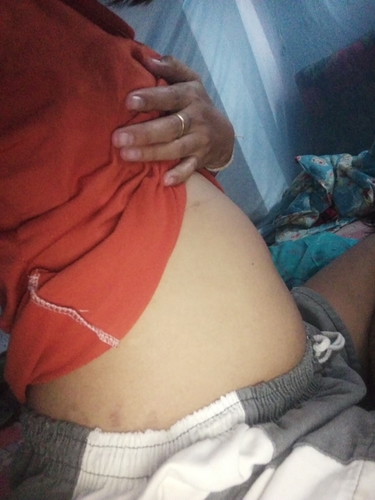 ขอดูท้องคุณแม่เป็นเบาหวานคณะตั้งครรภ์หน่อย