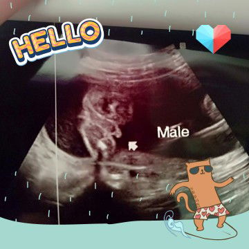 ทีมคลอดกุมภาพันธ์ 63จ้า