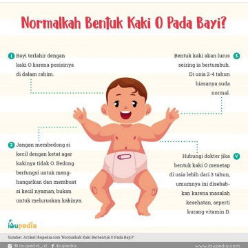 Normalkah Bentuk Kaki O pada Bayi?