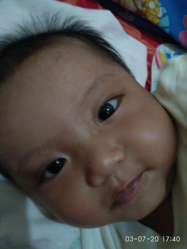 kulit bayi