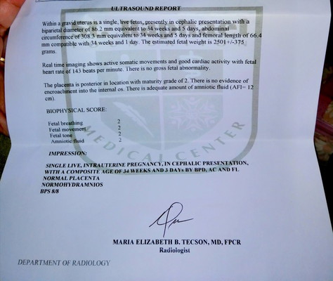 Accident Nadulas 34weeks. and 3days