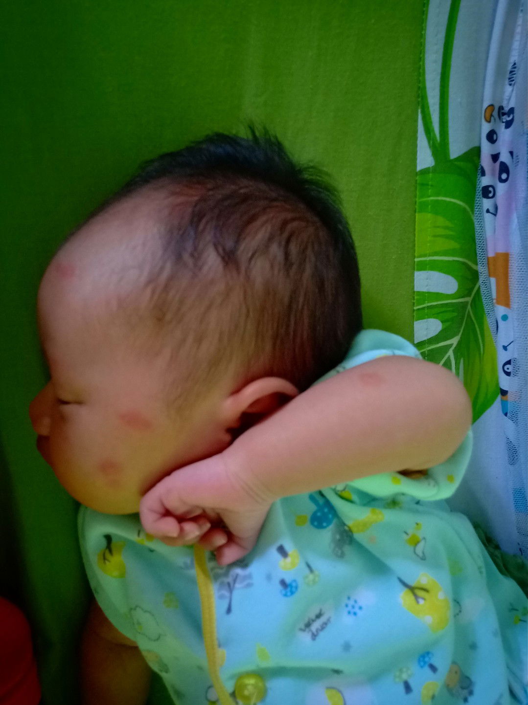 Ruam merah di kulit bayi