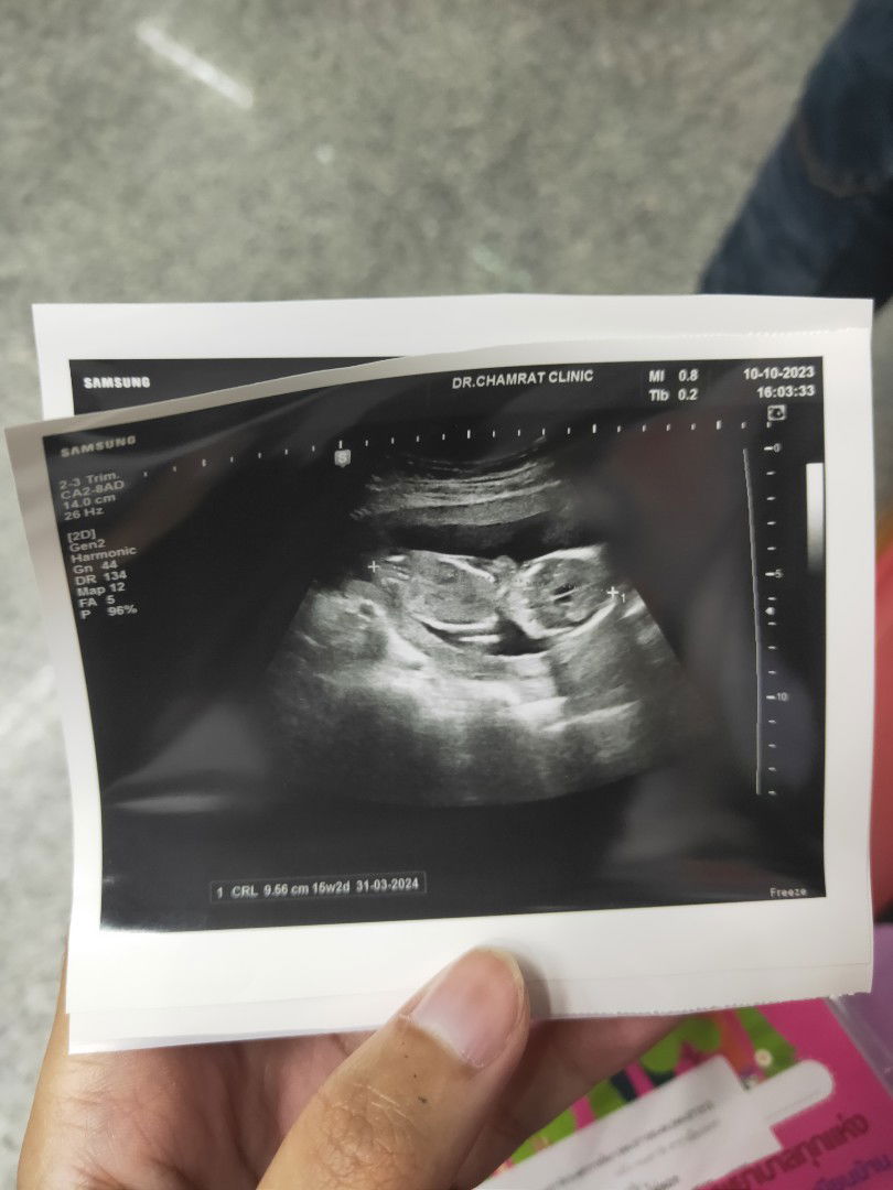 sararat profile icon