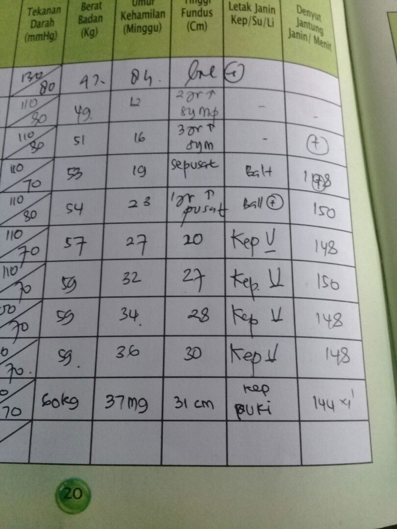 posisi bayi PUNGGUNG KIRI (PUKI)