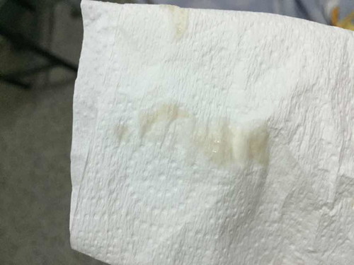 มูกสีน้ำตาล