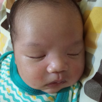 pipi merah