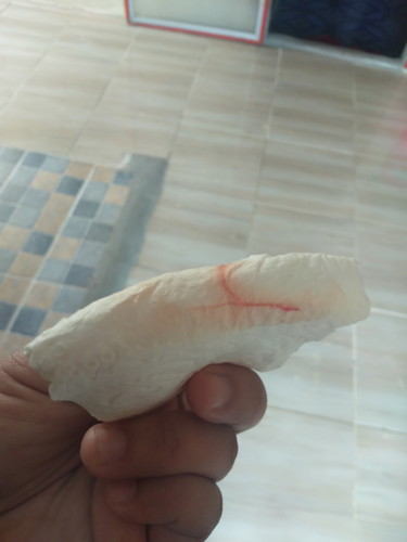 สอบถามท้องแรกค่ะ 38+4 แล้วค่ะ