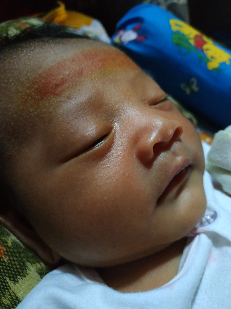 biang keringat ato apa.??