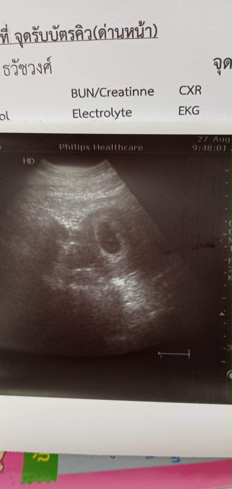 สวัสดีค่ะ เป็นครั้งที่สองที่กลับมาเล่นแอพนี้