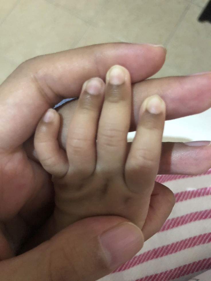 Dibawah kuku berwarna cokelat