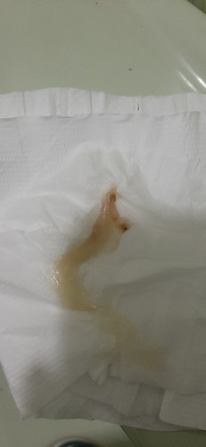 Mucus