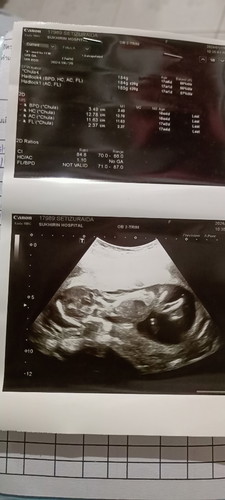 ช่วยดูหน่อยค่ะแม่ๆ