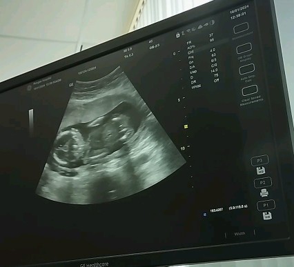 แบบนี้ลูกชายรึลูกสาวค่ะ ตื่นเต้นอยากด้ายสาวค่ะ รบกวนแม่ๆที่มีประสบการณ์หน่อยค่ะ